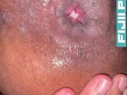 Ebony TikTok teen ass gaping on onlyfans  at fijiitv