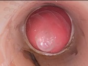 The camera in the deep pussy records a huge ejaculation of sperm into the condom 11/16