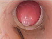 The camera in the deep pussy records a huge ejaculation of sperm into the condom 12/16