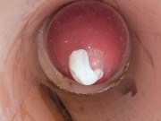 The camera in the deep pussy records a huge ejaculation of sperm into the condom 13/16