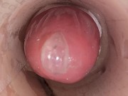 The camera in the deep pussy records a huge ejaculation of sperm into the condom 2/16
