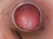 The camera in the deep pussy records a huge ejaculation of sperm into the condom 3/16