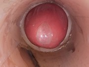 The camera in the deep pussy records a huge ejaculation of sperm into the condom 4/16