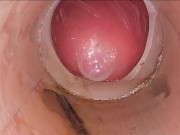The camera in the deep pussy records a huge ejaculation of sperm into the condom 6/16