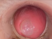 The camera in the deep pussy records a huge ejaculation of sperm into the condom 8/16