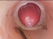 The camera in the deep pussy records a huge ejaculation of sperm into the condom 9/16