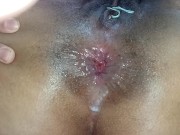 anal, daddy cumming inside my ass in missionary extreme filling my ass with sperm🍆🥛🍑🕳🥛💦🤤😵😋 14/16