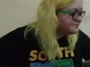 Amputee eats burger 6/16